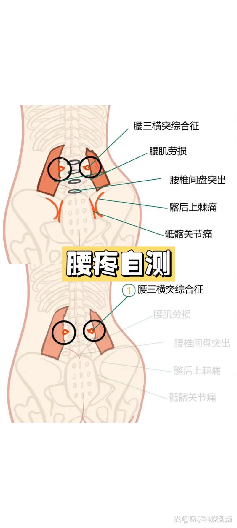 为什么经常腰痛(为什么经常腰疼)