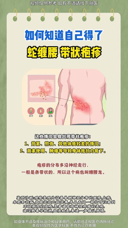 为什么得疱疹病毒(带状疱疹最危险的三个部位)