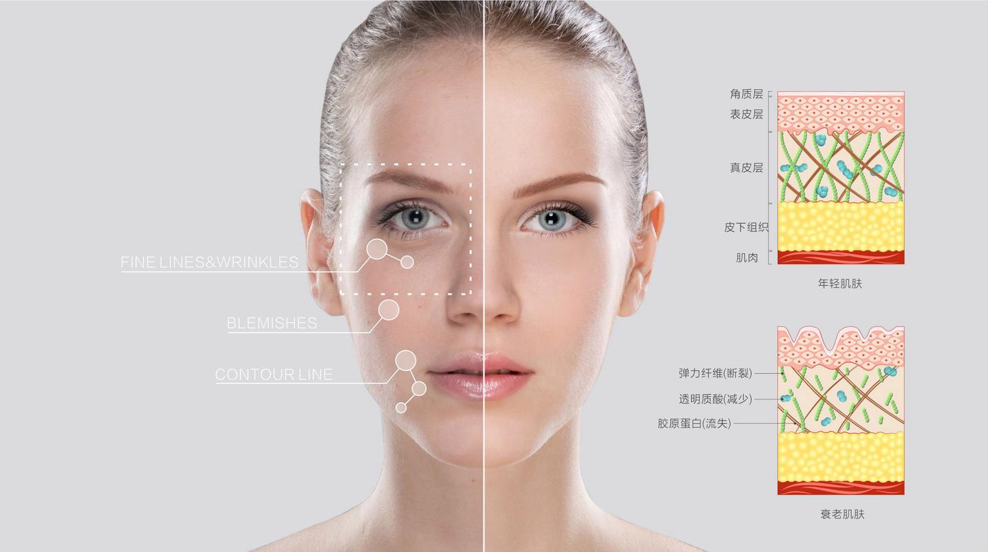 填充胶原蛋白维持多久(填充胶原蛋白有什么副作用)