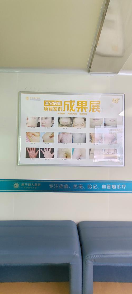 激光祛疤多久恢复(激光祛疤后多久有效果)