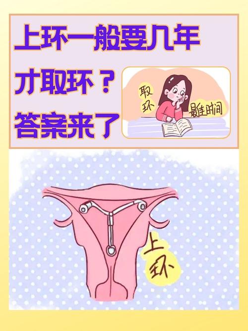 上环后多久来月经才算正常(上环后多久来月经是正常的)
